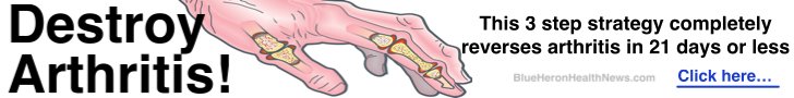 Arthritis